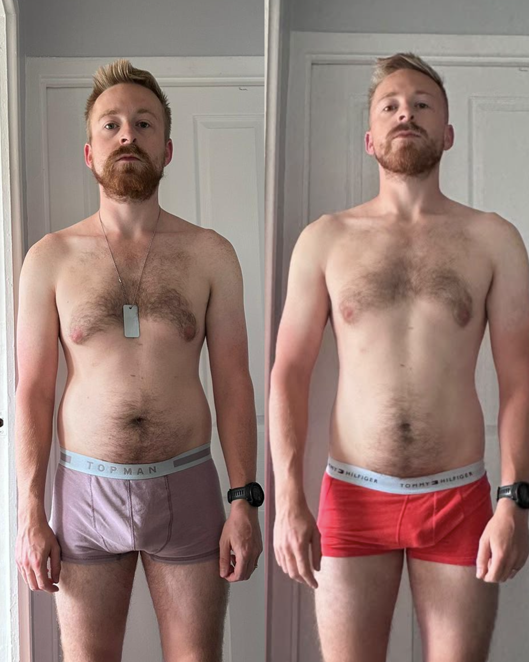 Client before and after transformation, front